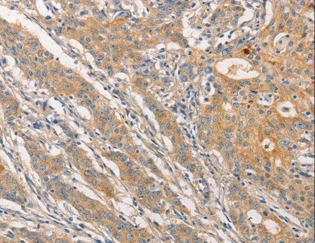 STAM1 / STAM Antibody