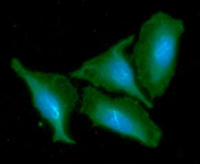 CKMT1A Antibody (clone AT17A2)