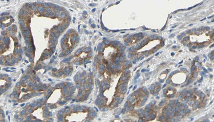 ARHGEF10 / GEF10 Antibody