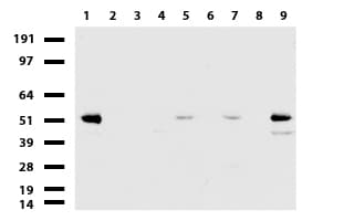 ABAT Antibody (aa29-323, clone UMAB178, Carrier-free)