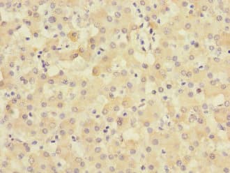 Polyclonal Rabbit anti-Human TIMM50 Antibody (IHC, WB)