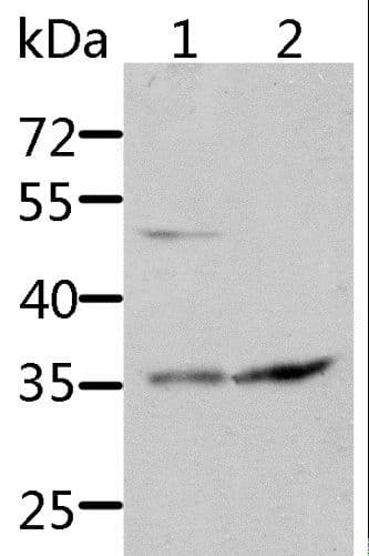 Polyclonal Rabbit anti-Human SOCS1 Antibody (IHC, WB)