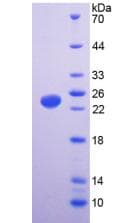 Human VR1 / TRPV1 Protein (Recombinant His, N-terminus)