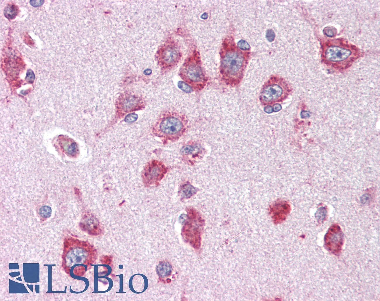 IHC-plus™ ACVR1C / ALK7 Antibody