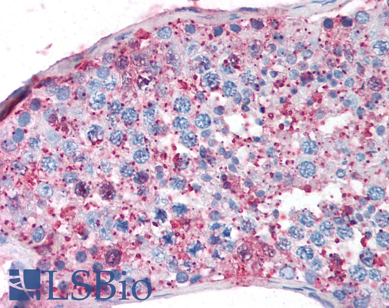 IHC-plus™ Polyclonal Rabbit anti-Human NR5A1 / SF1 Antibody (C-Terminus, IHC)