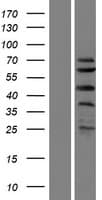 Human SPRTN / C1orf124 Protein (Over-Expression Lysate Myc-DDK (Flag))