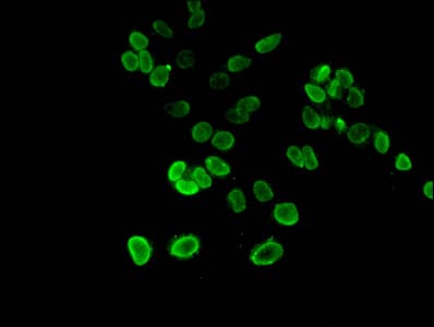 Polyclonal Rabbit anti-Human HIST1H3A Antibody (IHC, IF, WB)