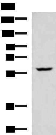 Polyclonal Rabbit anti-Human PDCD4 Antibody (IHC, WB)