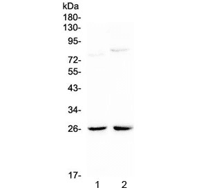 Polyclonal Rabbit anti-Mouse NMU / Neuromedin U Antibody (WB)