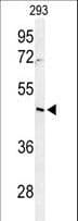 RRS1 Antibody (aa336-365)