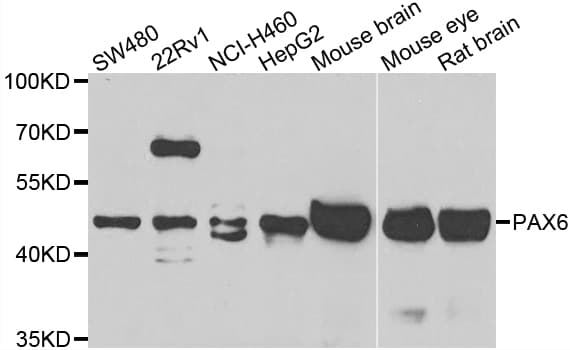 Polyclonal Rabbit anti-Human PAX6 Antibody (IHC, IF, WB)