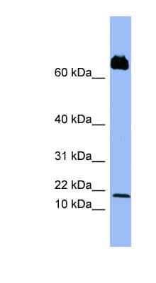 Polyclonal Rabbit anti-Human PF4V1 Antibody (C-Terminus, WB)