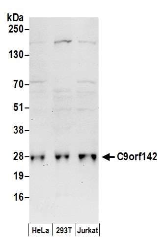 Polyclonal Rabbit anti-Human C9orf142 Antibody (aa154-204, WB)