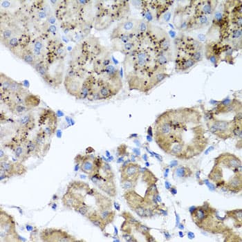 Polyclonal Rabbit anti-Human PPOX Antibody (IHC, IF, WB)