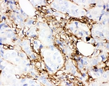 ANXA5 / Annexin V Antibody (aa2-320)