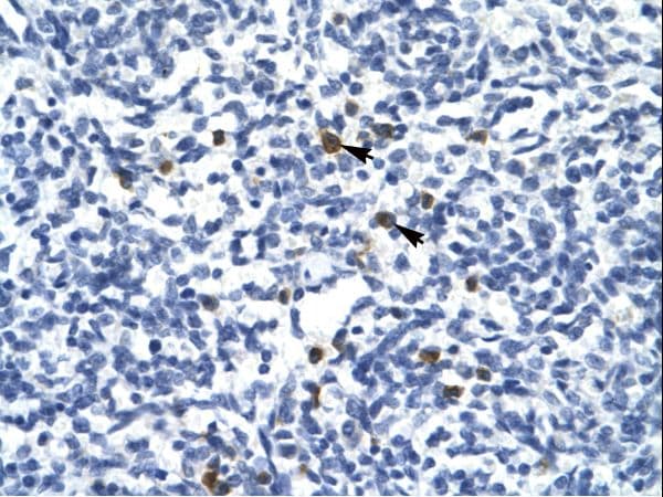 Polyclonal Rabbit anti-Human TAL1 Antibody (Biotin, aa236-285, IHC, WB)