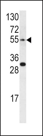 EDNRA / Endothelin A Receptor Antibody (aa125-154)
