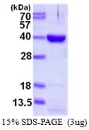 Human DIMT1L Protein (Recombinant His)