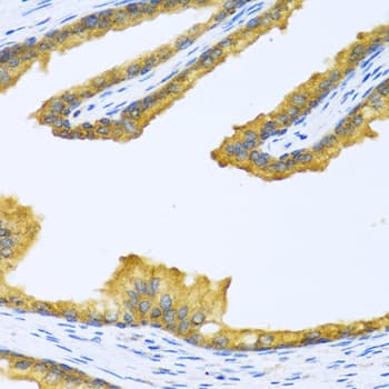 BTD / Biotinidase Antibody