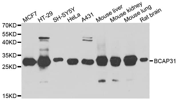 BCAP31 / BAP31 Antibody