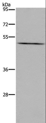 Polyclonal Rabbit anti-Human PTGER4 / EP4 Antibody (WB)
