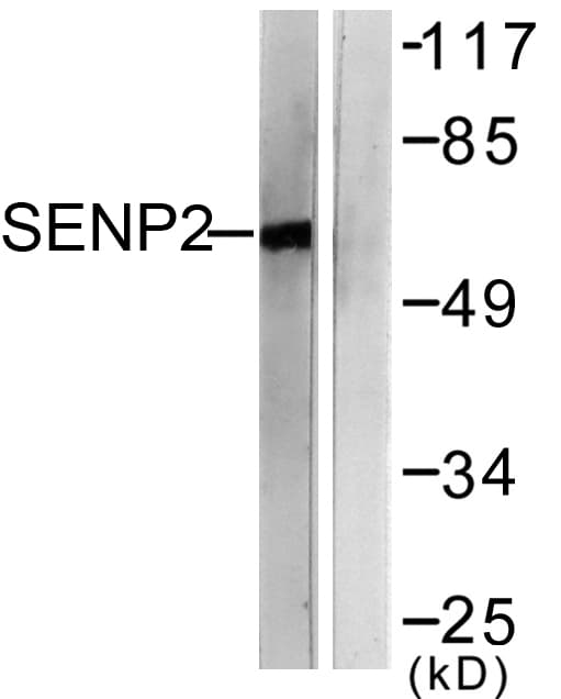 Polyclonal Rabbit anti-Human SENP2 Antibody (aa481-530, WB)