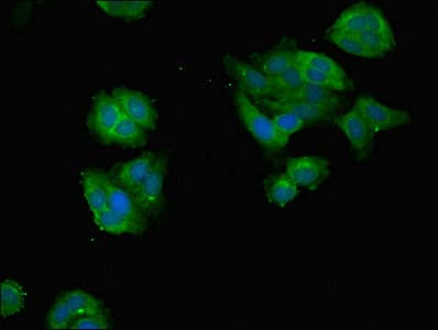 Polyclonal Rabbit anti-Human DDX3 / DDX3X Antibody (aa2-662, IHC, WB)