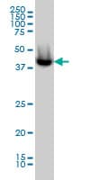 IHC-plus™ Monoclonal Mouse anti-Human ACOT9 Antibody (clone 4E4, IHC, IF, WB)