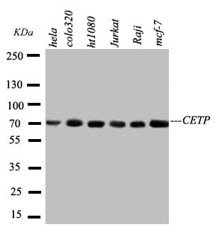 Polyclonal Rabbit anti-Human CETP Antibody (aa368-382, WB)