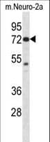 IHC-plus™ PAK4 Antibody (aa187-216)