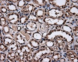 Heat Shock Protein 70 / HSPA1A Antibody (clone OTI3G9)