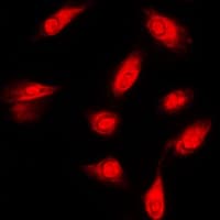 FER Antibody (C-Terminus)