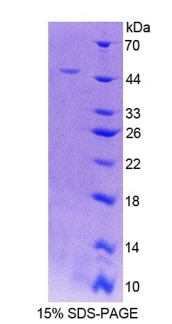 Human RFK Protein (Recombinant His-GST)