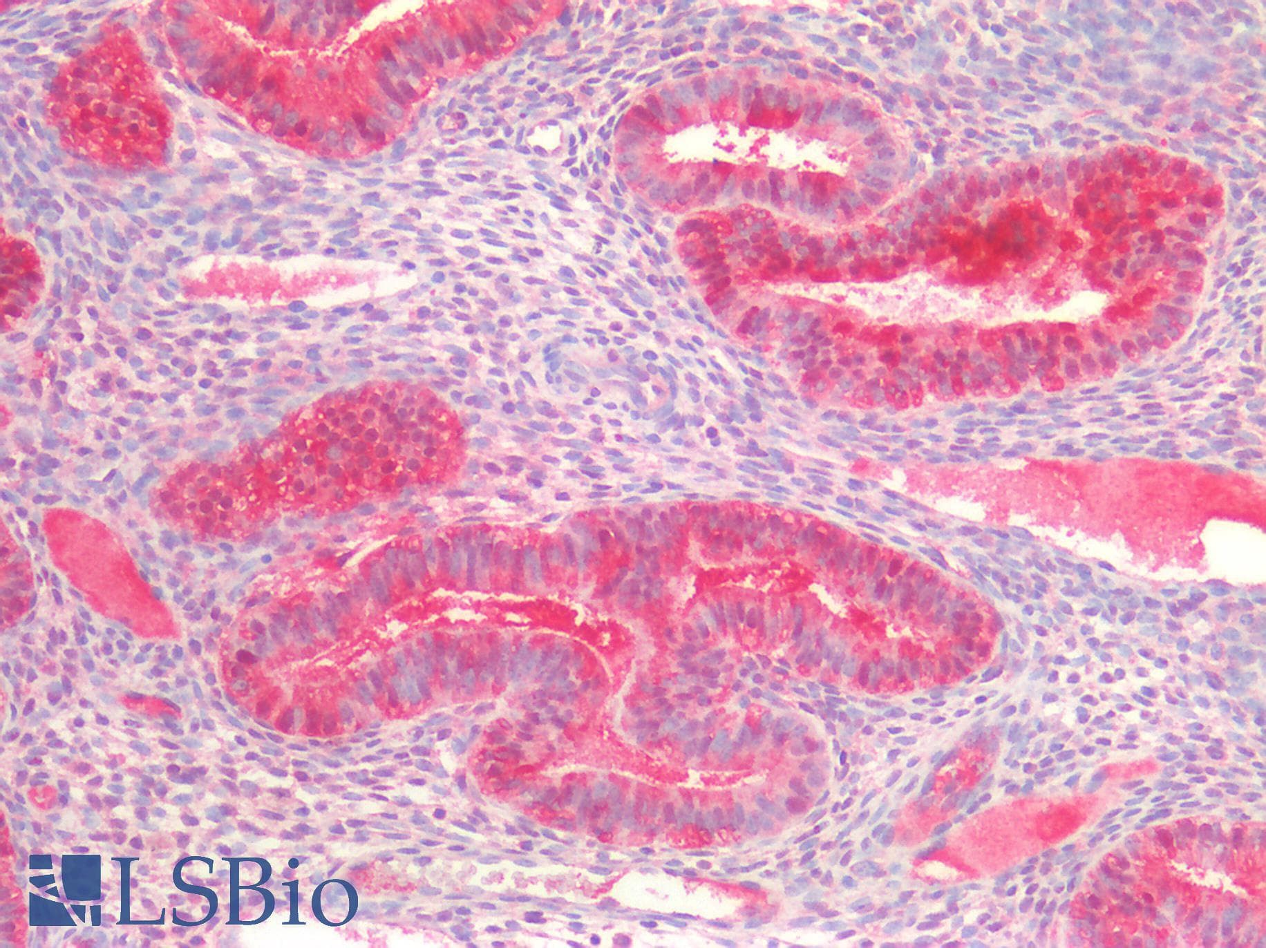IHC-plus™ HPRT1 / HPRT Antibody (aa23-218)