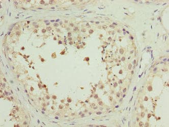 MRPL27 Antibody