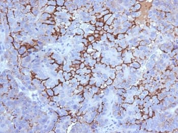 MUC16 / CA125 Antibody (clone 5E11., Azide-free, BSA-free)