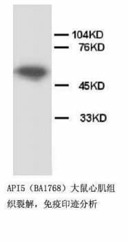 Polyclonal Rabbit anti-Human API5 Antibody (Sepharose, C-Terminus)