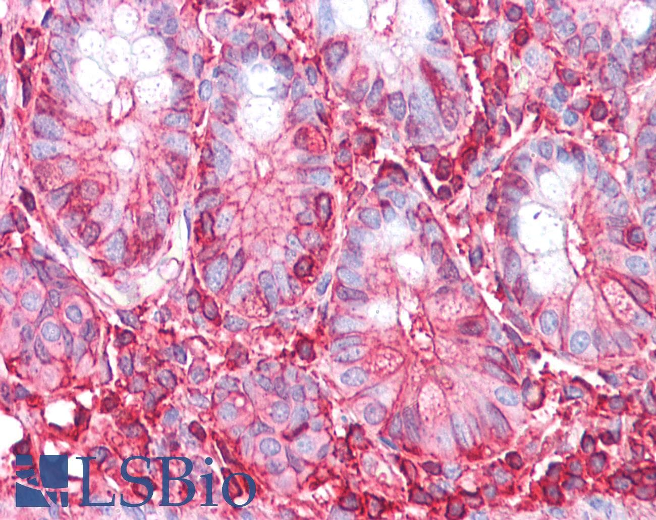 IHC-plus™ Monoclonal Mouse anti-Human ACTG1 / Gamma Actin Antibody (clone 2A3, IHC, WB)