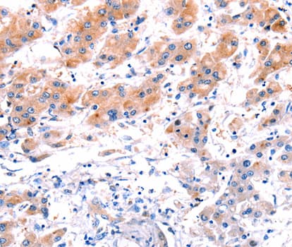 Polyclonal Rabbit anti-Human CLEC4D / MCL Antibody (IHC, WB)