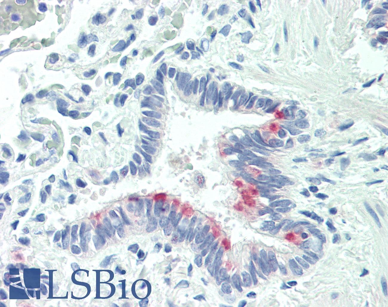 IHC-plus™ HsT19268 / MTHFS Antibody (aa148-160)