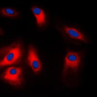 IHC-plus™ HSPA5 / GRP78 / BiP Antibody (C-Terminus)
