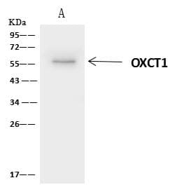 OXCT1 Antibody