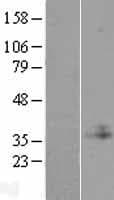 C1GALT1C1 Protein (Over-Expression Lysate Myc-DDK (Flag))