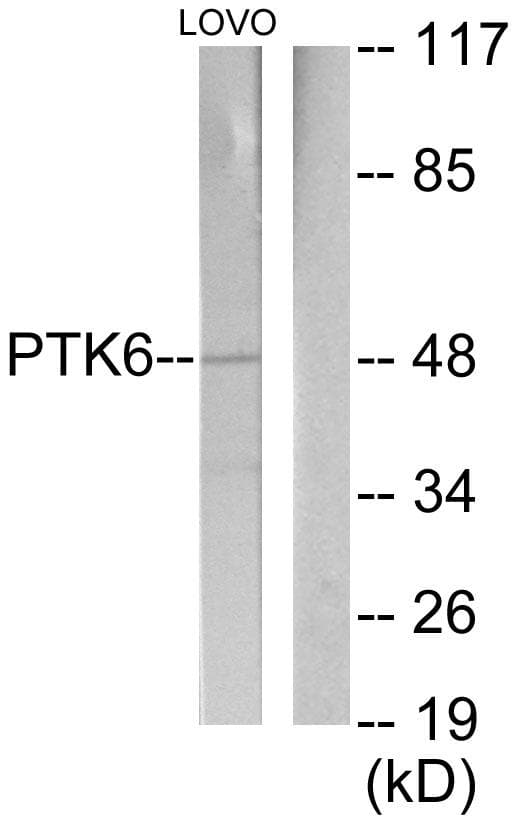 PTK6 / BRK Antibody