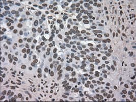 DHFR Antibody (clone OTI3A11, Carrier-free)