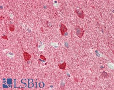 Polyclonal Rabbit anti-Human TSC22D2 Antibody (N-Terminus, IHC, WB)