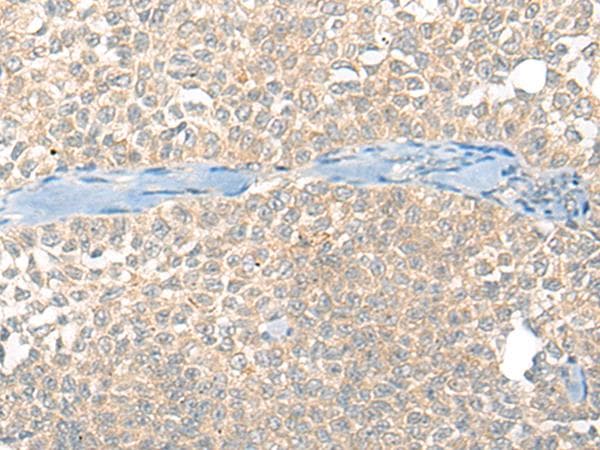 Polyclonal Rabbit anti-Human SNX6 Antibody (IHC)