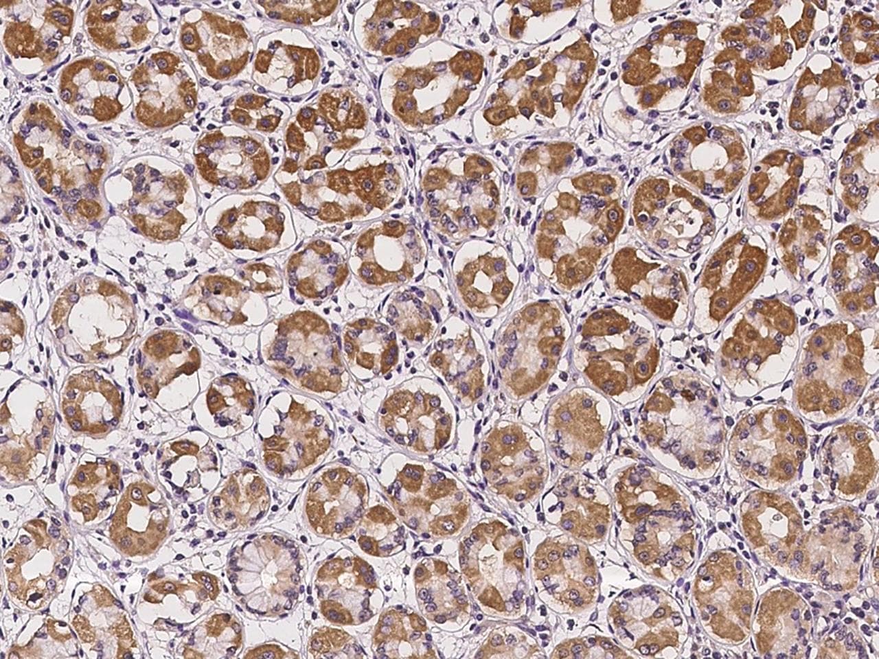 CDw218a / IL18R1 Antibody