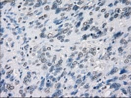 MAP2K1 / MKK1 / MEK1 Antibody (clone OTI1F5)