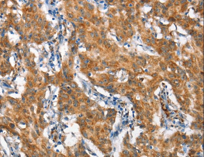 STAT2 Antibody